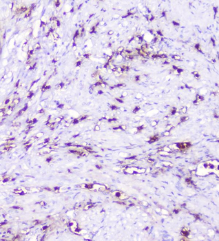 CXCL12 Rabbit Polyclonal Antibody