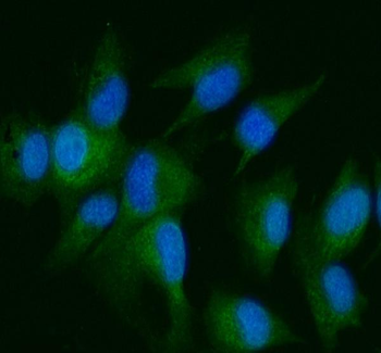 DDR2 Rabbit Polyclonal Antibody