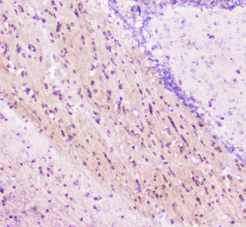 ELAVL2 HuB Rabbit Polyclonal Antibody