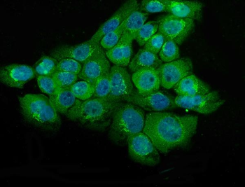 NSE/ENO2 Rabbit Polyclonal Antibody