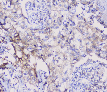 NSE/ENO2 Rabbit Polyclonal Antibody