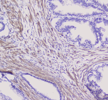 NSE/ENO2 Rabbit Polyclonal Antibody