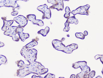 NSE/ENO2 Rabbit Polyclonal Antibody