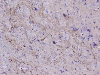 NSE/ENO2 Rabbit Polyclonal Antibody