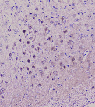 NSE/ENO2 Rabbit Polyclonal Antibody