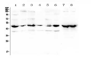 NSE/ENO2 Rabbit Polyclonal Antibody