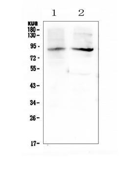 XPB/ERCC3 Rabbit Polyclonal Antibody