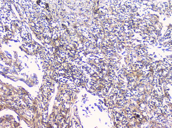 FCGR2A Rabbit Polyclonal Antibody