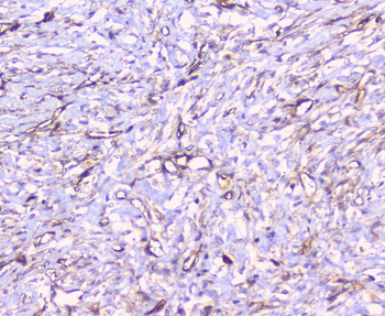FCGR2A Rabbit Polyclonal Antibody