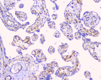 FCGR2A Rabbit Polyclonal Antibody