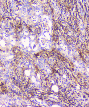 FCGR2A Rabbit Polyclonal Antibody