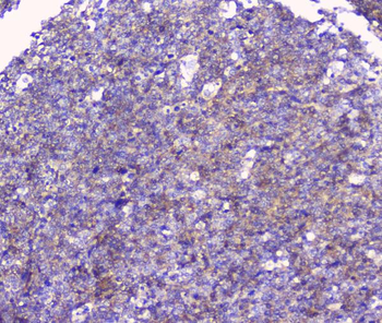 FCGR2A Rabbit Polyclonal Antibody