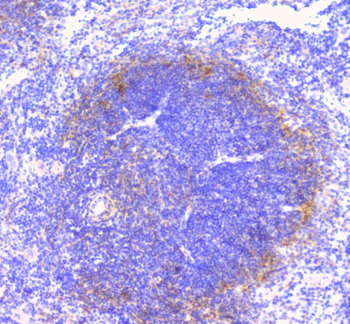 FCGR2A Rabbit Polyclonal Antibody