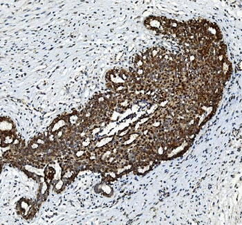 FGF2 Rabbit Polyclonal Antibody
