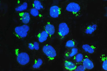 GM130/GOLGA2 Rabbit Polyclonal Antibody