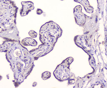 GM130/GOLGA2 Rabbit Polyclonal Antibody