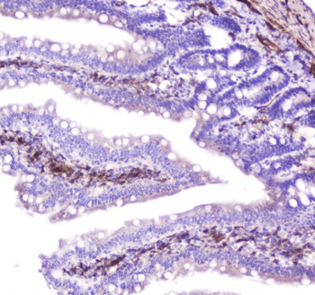 Hsp27/Hspb1 Rabbit Polyclonal Antibody
