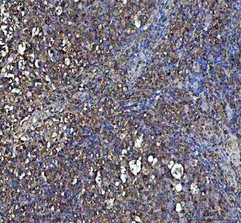 Interferon gamma/IFNG Rabbit Polyclonal Antibody