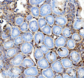 Interferon gamma/IFNG Rabbit Polyclonal Antibody