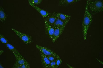 INPPL1 Rabbit Polyclonal Antibody