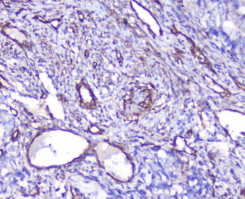 INPPL1 Rabbit Polyclonal Antibody