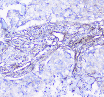 INPPL1 Rabbit Polyclonal Antibody