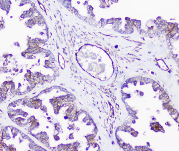 INPPL1 Rabbit Polyclonal Antibody