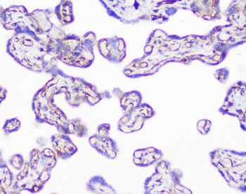 INPPL1 Rabbit Polyclonal Antibody