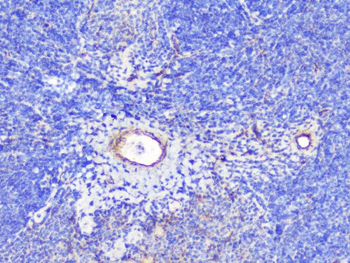INPPL1 Rabbit Polyclonal Antibody