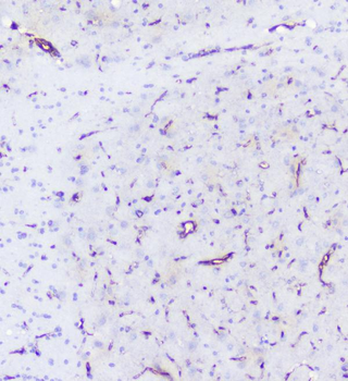 INPPL1 Rabbit Polyclonal Antibody