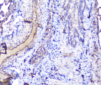 INPPL1 Rabbit Polyclonal Antibody