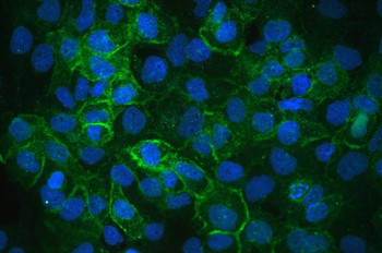 Integrin alpha 3/ITGA3 Rabbit Polyclonal Antibody