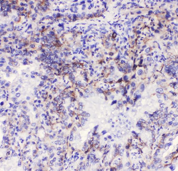 Integrin alpha 3/ITGA3 Rabbit Polyclonal Antibody