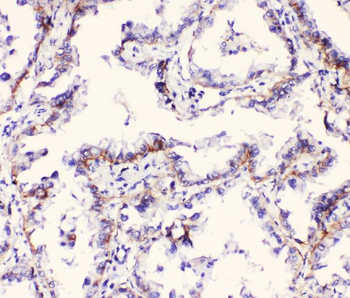Integrin alpha 3/ITGA3 Rabbit Polyclonal Antibody