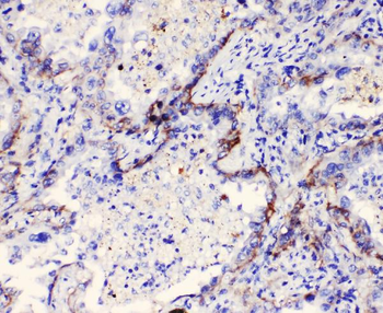 Integrin alpha 3/ITGA3 Rabbit Polyclonal Antibody