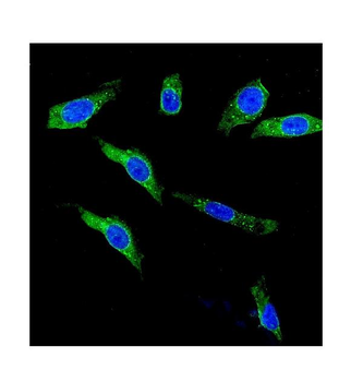 KCNH1 Rabbit Polyclonal Antibody