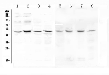 KCNN4 Rabbit Polyclonal Antibody