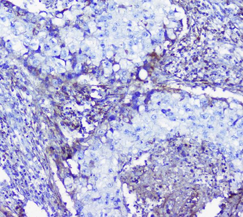 Lumican Rabbit Polyclonal Antibody
