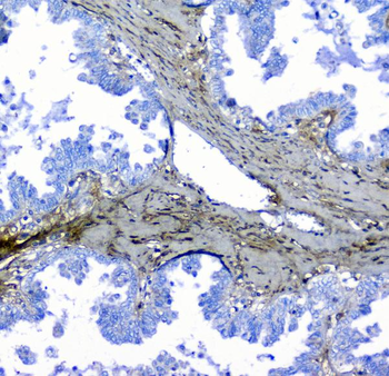 Lumican Rabbit Polyclonal Antibody