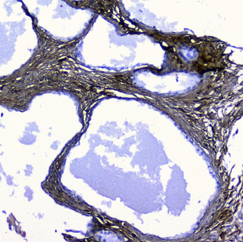 Lumican Rabbit Polyclonal Antibody