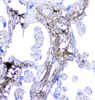 Lumican Rabbit Polyclonal Antibody