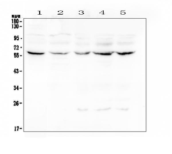 Lumican Rabbit Polyclonal Antibody