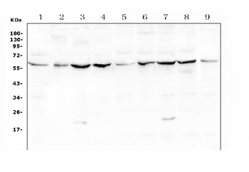 Lumican Rabbit Polyclonal Antibody