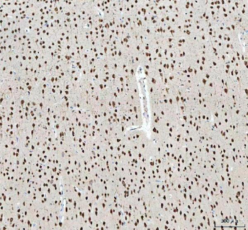 Nova1 Rabbit Polyclonal Antibody