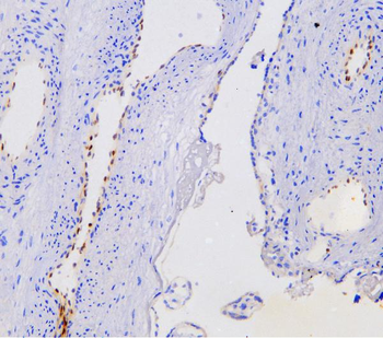 Nova1 Rabbit Polyclonal Antibody