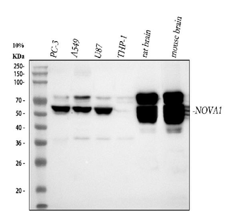 Nova1 Rabbit Polyclonal Antibody