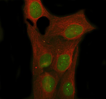 Nova1 Rabbit Polyclonal Antibody