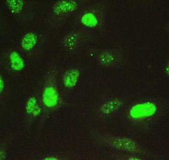 Nova1 Rabbit Polyclonal Antibody
