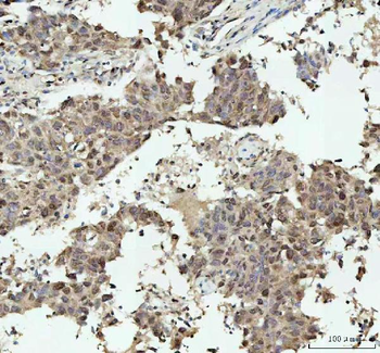 Nova1 Rabbit Polyclonal Antibody