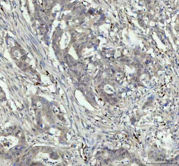 Nova1 Rabbit Polyclonal Antibody